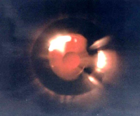 34